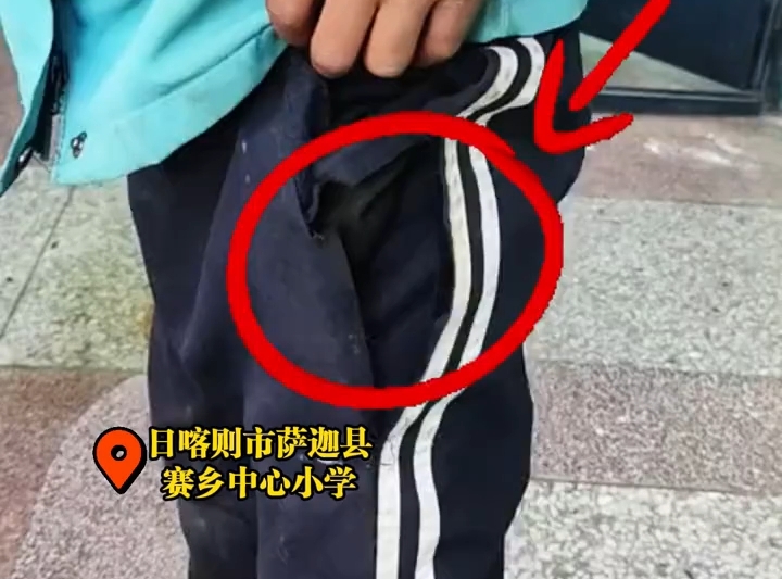 一针一线显温情，老师亲自为学生缝补裤子